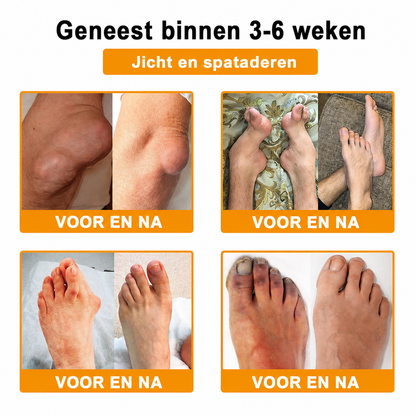 🔥 Laatste kans! Profiteer nu van deze geweldige aanbieding met 80% KORTING!  🎁 180 dagen niet-goed-geld-terug-garantie ✈️ Gratis verzending via luchtpost  Natravor®
