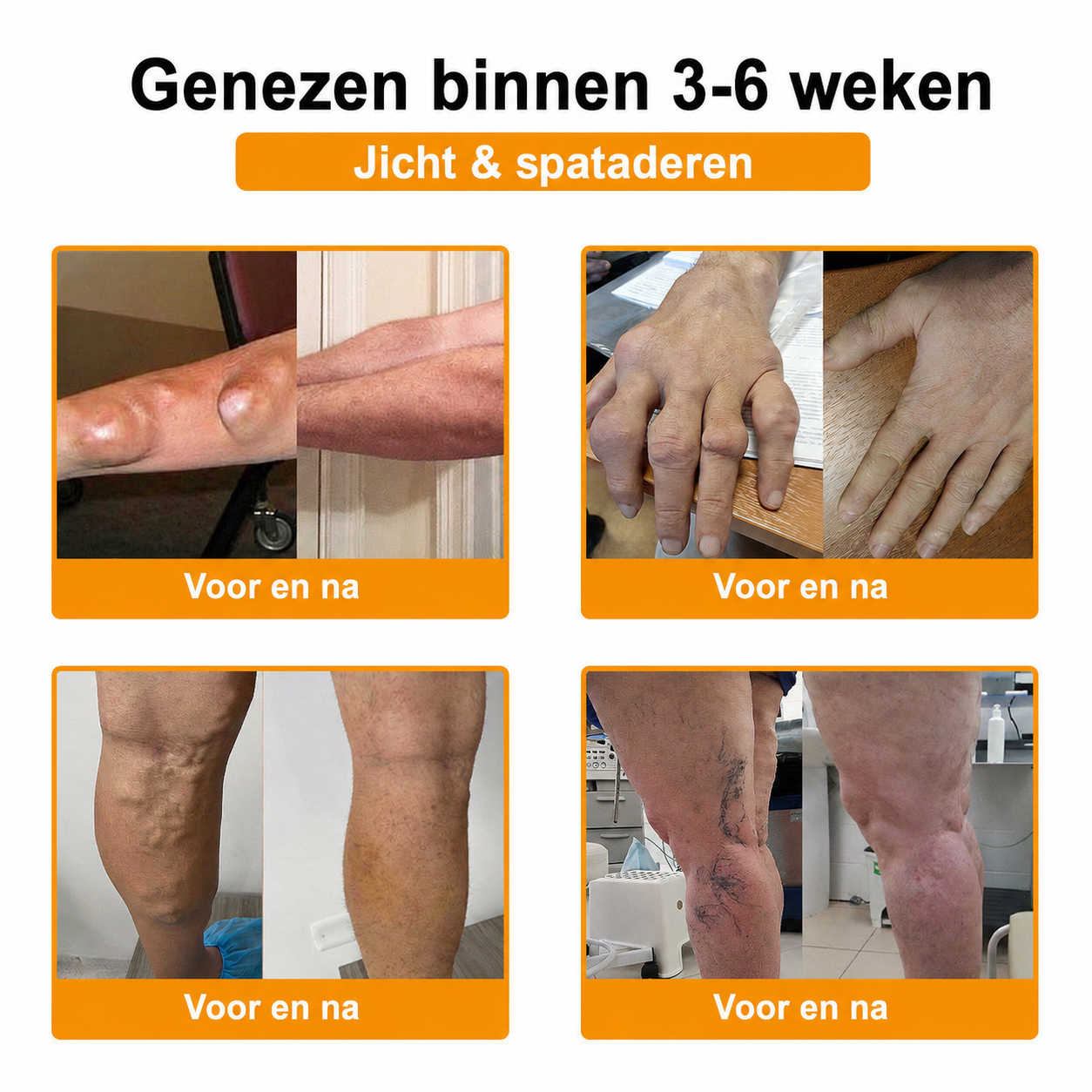 🔥 Laatste kans! Profiteer nu van deze geweldige aanbieding met 80% KORTING!  🎁 180 dagen niet-goed-geld-terug-garantie ✈️ Gratis verzending via luchtpost  Natravor®