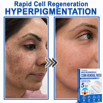 ✨TopSpire® 2-in-1 Microneedle & Hydrocolloid Patch | Targeted Solution for Raised Moles, Acne, Flat Warts & Skin Tags | Helps Improve the Appearance of Fine Lines, Scars & Skin Imperfections | Invisible Star Pimple Patches for Face & Body